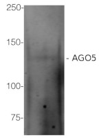 AGO5 | Argonaute 5 in the group Antibodies Plant/Algal / DNA/RNA/Cell Cycle / plant RNA at Agrisera AB (Antibodies for research) (AS10 671)